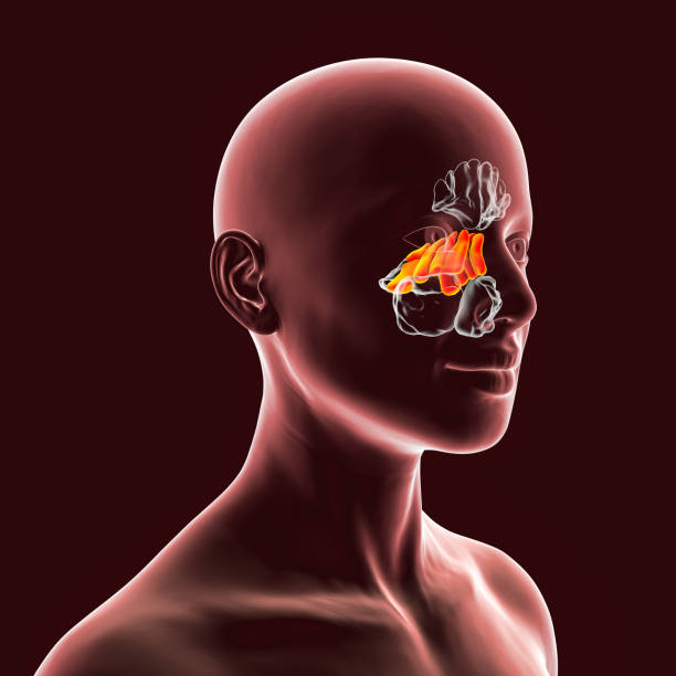 sinus surgery