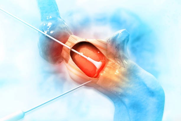 Microlaryngeal Surgery