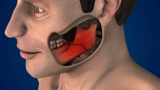 tonsillectomy