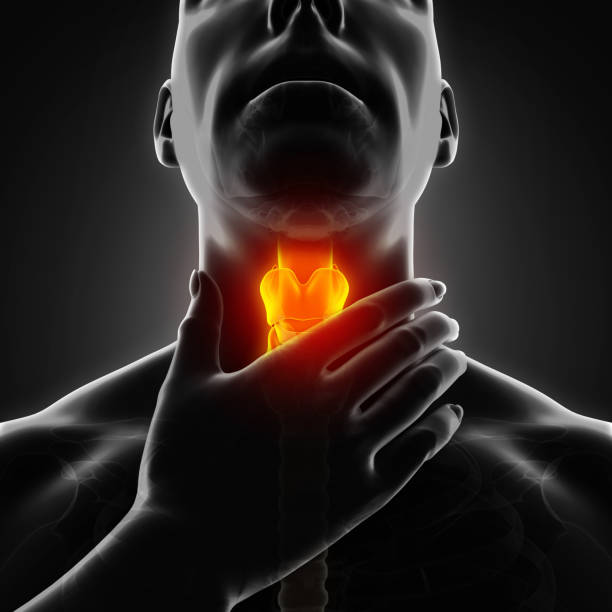 tonsillitis
