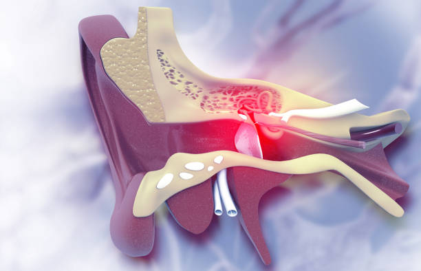 tympanoplasty